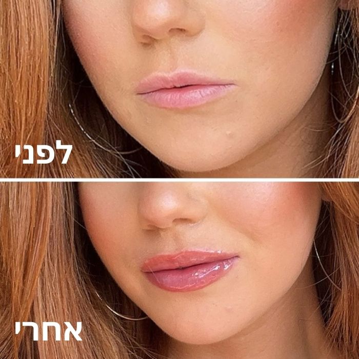 Farendel - מעניק נפח לשפתיים